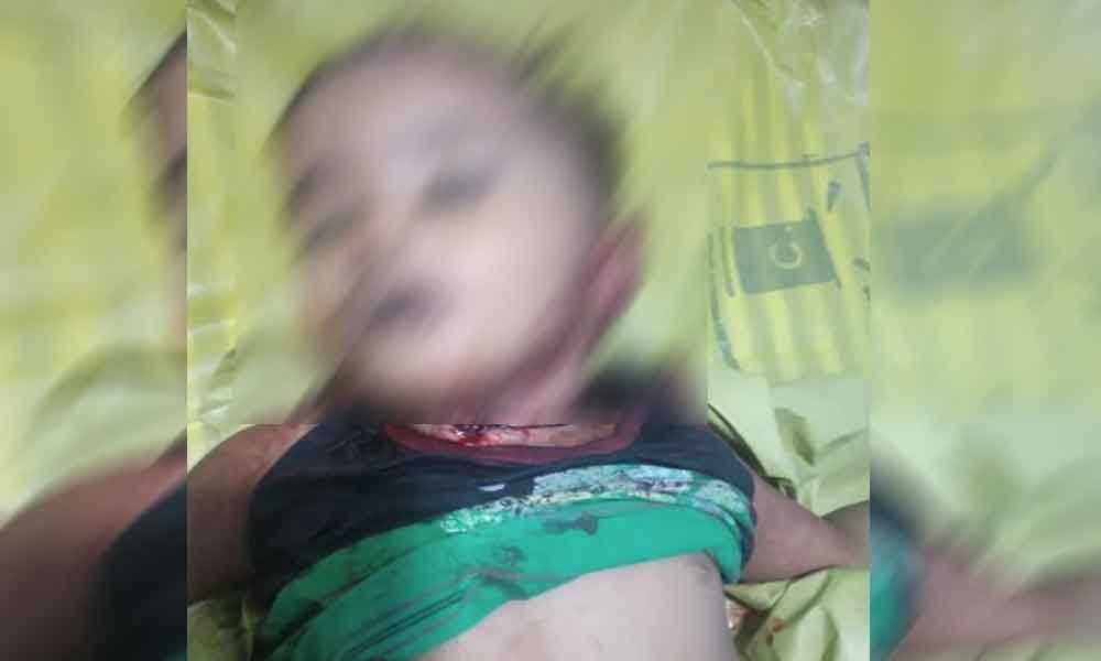 Mother kills her daughter under depression in Jeedimetla PS limits