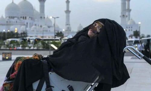 Emirati woman wakes up from coma after 27 years in stable condition