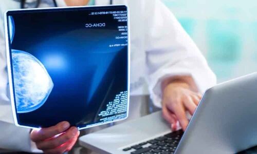 Breast cancer can now be predicted by AI