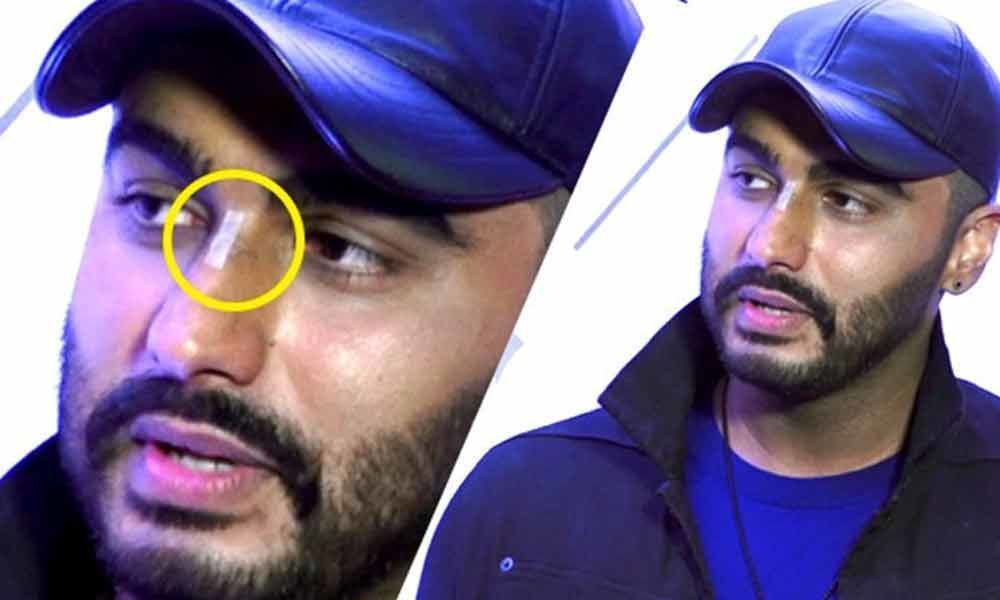 It is a nice memory of Panipat: Arjun Kapoor on the nose injury on sets of Panipat
