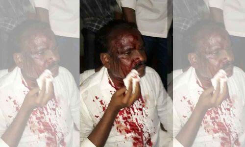 Candidate injured in rival attack