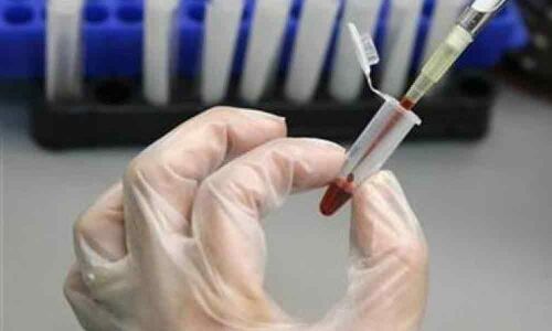 At least 400 Pakistanis infected with HIV after doctor used contaminated syringes