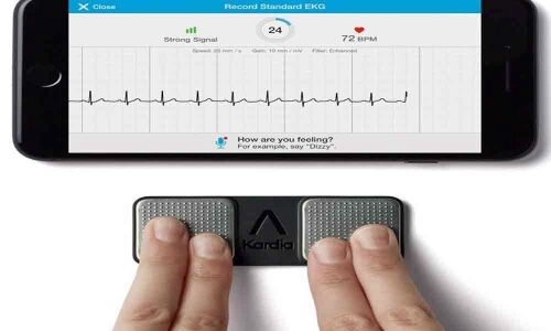 Simple device can help monitor stress levels