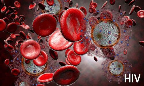 Pakistan town struggles with surge in HIV infections