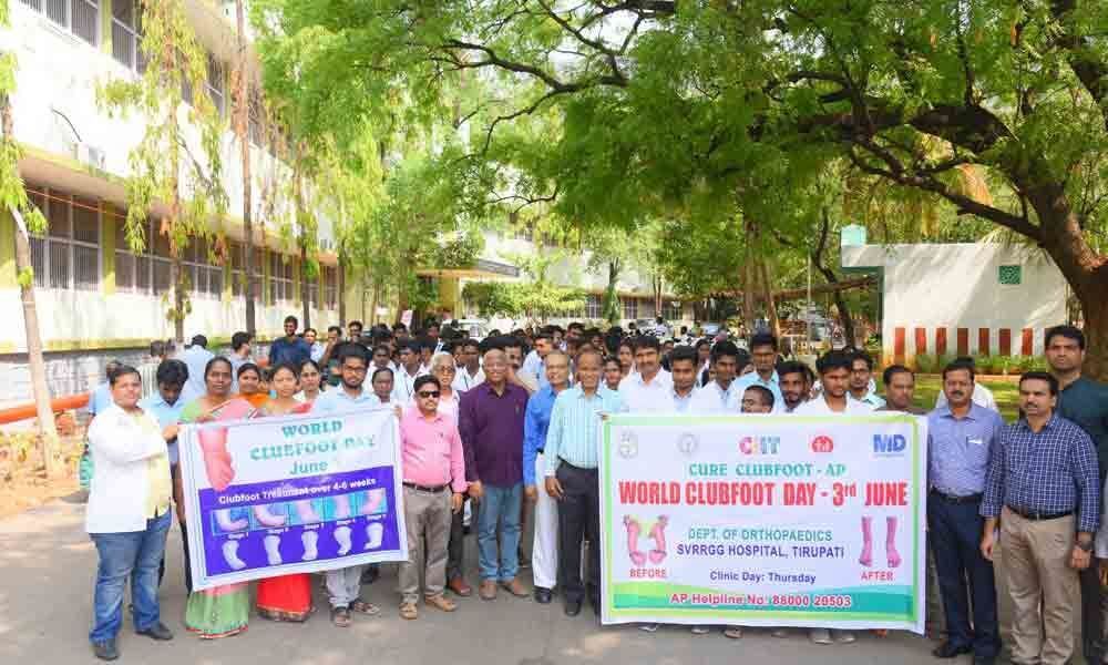 Rally to spread awareness on clubfoot deformity held in Tirupati