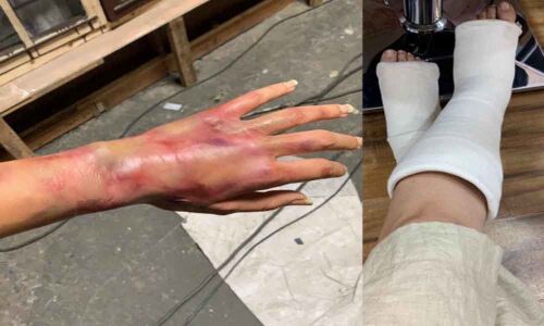 Tapsee shares a photo that makes her fans worry!