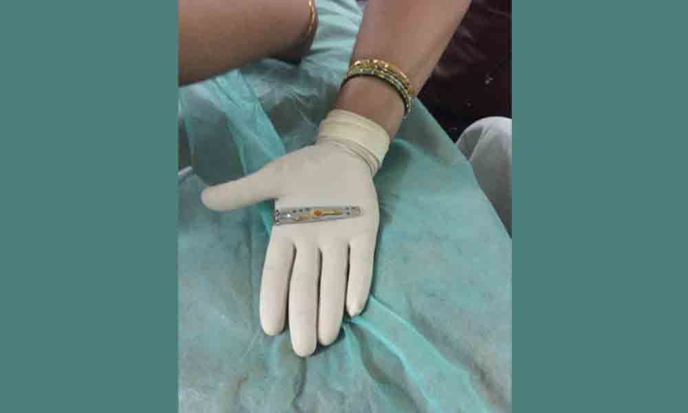 Nail cutter removed from toddlers stomach in Guntur