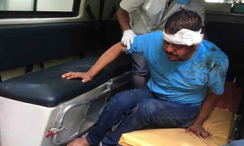 Accidents become normal affair in Pragati Nagar