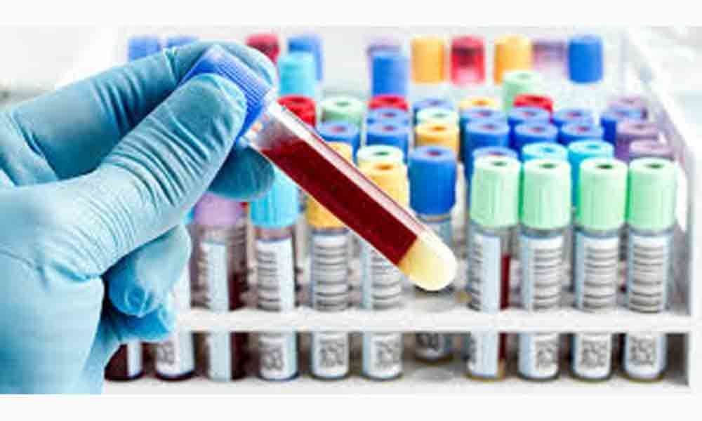 Diagnostic labs proposal to offer tests cheap pending in Tirupati