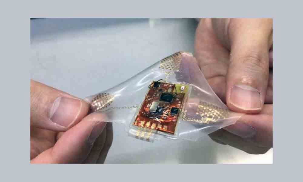 Soft wearable health monitor developed using stretchable electronics