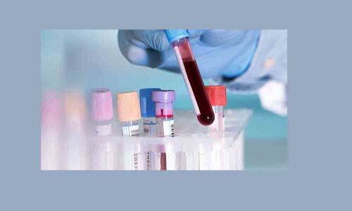 IIT Kharagpur researchers develop low-cost blood test device