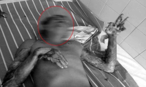 Man catches current wires with anger on wife in Chittoor district