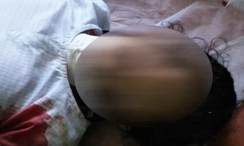 Girl attacked in Anakapalle, wounded seriously