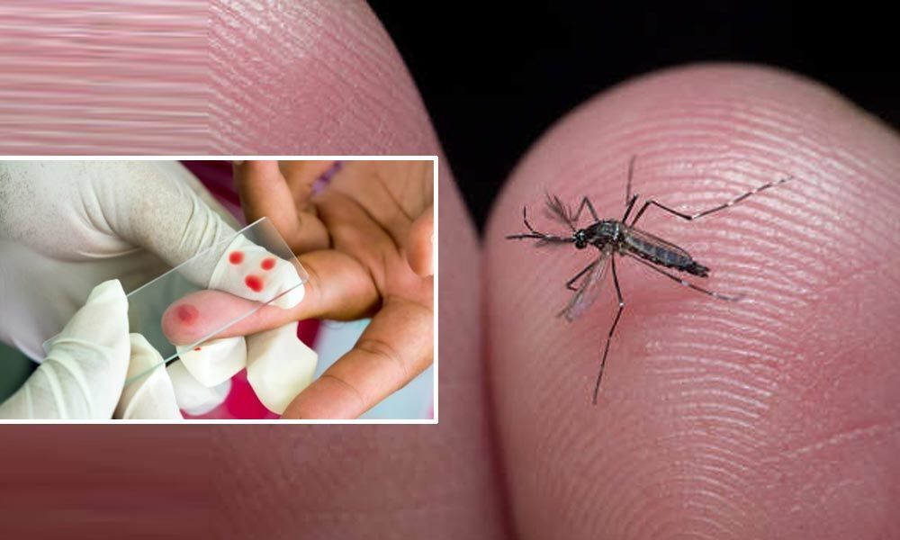 Malaria linked to 30% higher risk of heart failure