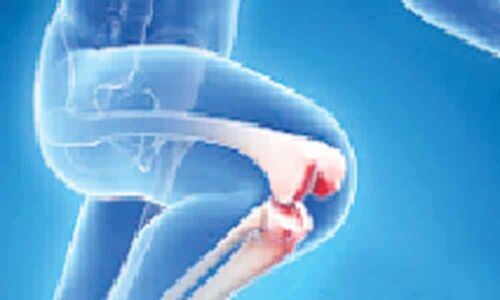 India staring at knee ailments epidemic