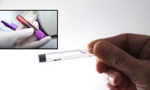 FDA grants market authorisation for Zika diagnostic test