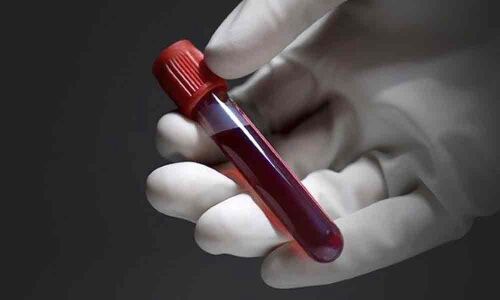 Blood test can predict gut microbes diversity