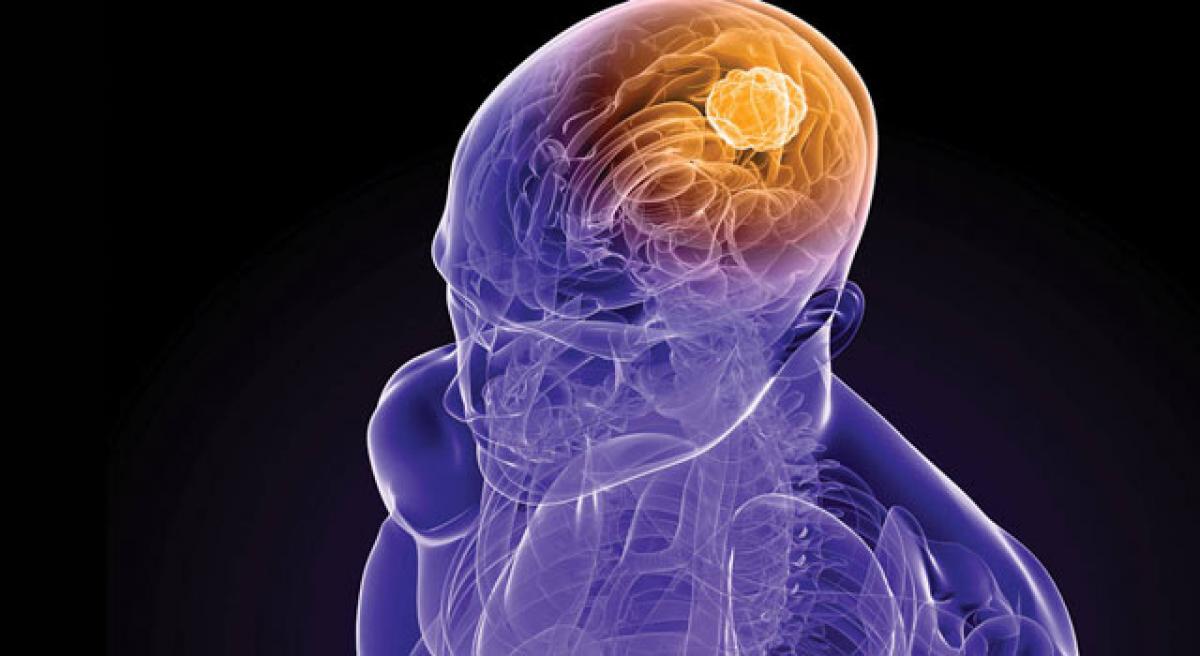 Predisposition to brain cancer can be detected five years in advance