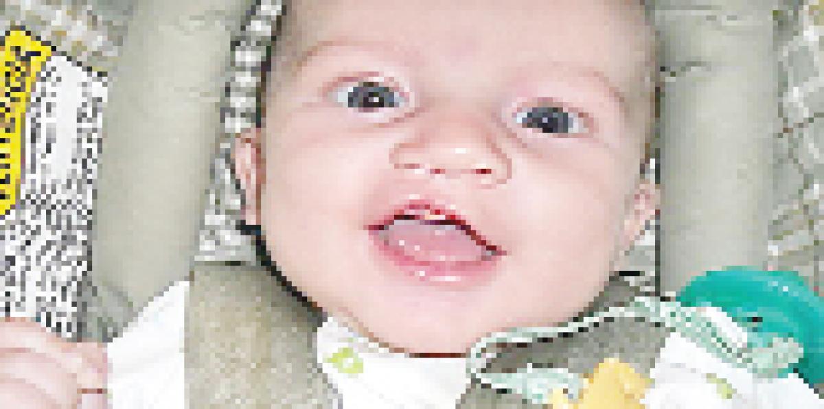 Cleft patients have something to smile about