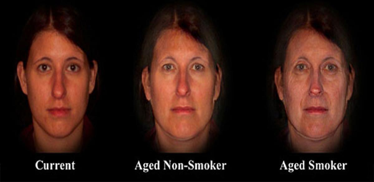 What accelerates ageing in smokers?