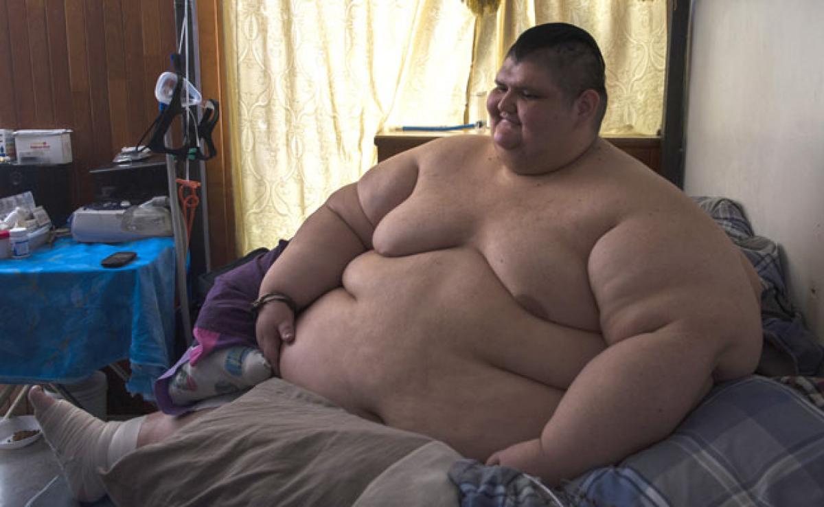 Worlds Most Obese Man, 32, Has Been On 3-Month Diet For Surgery: Report