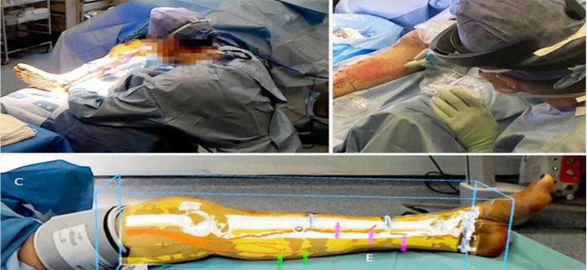 Surgeons see through tissue using AR headset