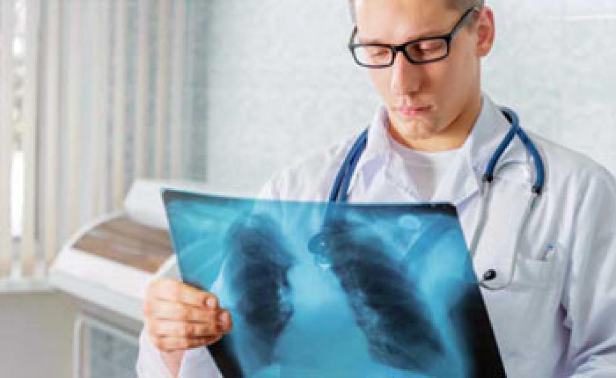 Biomarker of early lung cancer identified