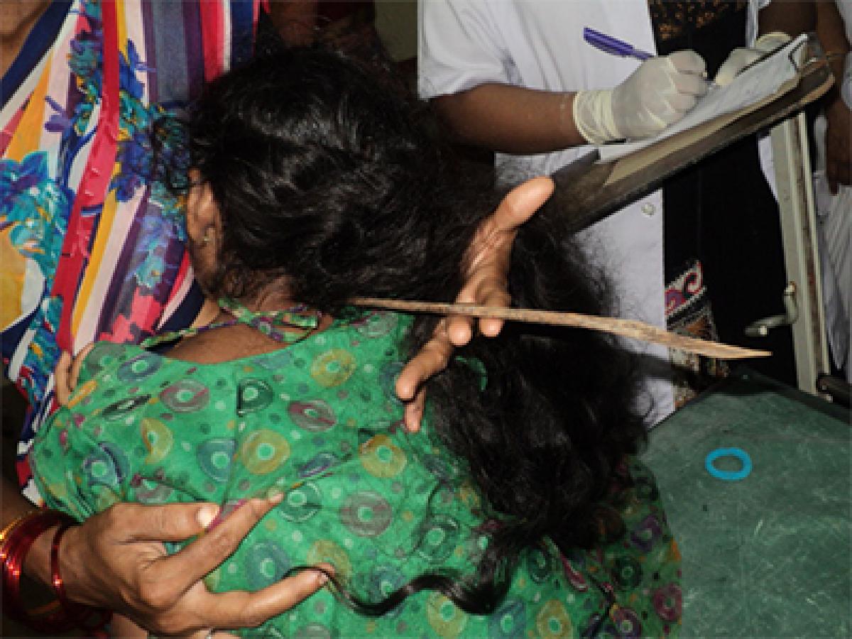 Doctors remove spatula from girl’s neck