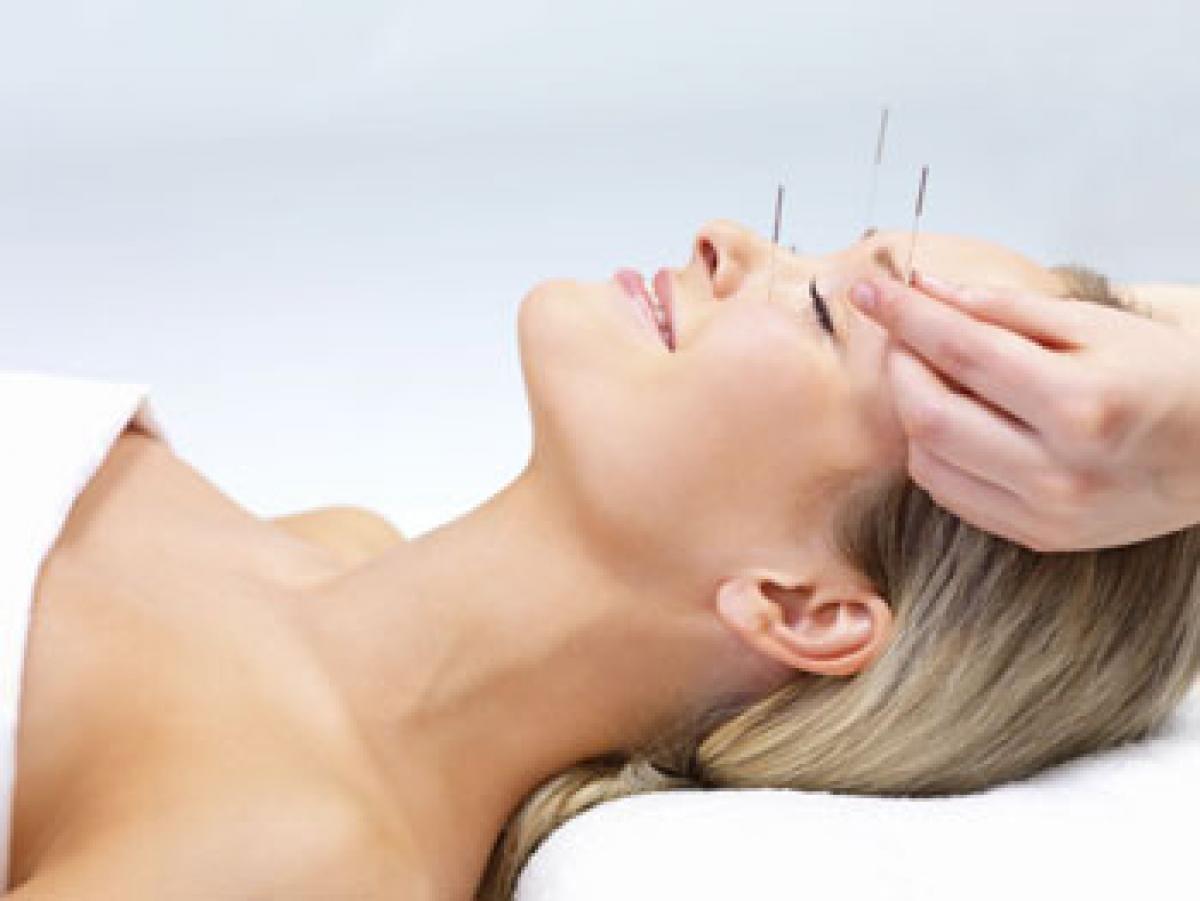 Just 20 minutes acupuncture can reduce chronic pain