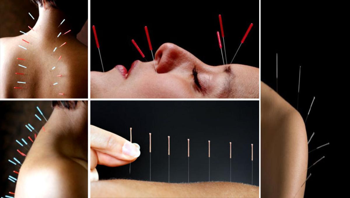 Acupuncture may help hypertensive patients, finds study