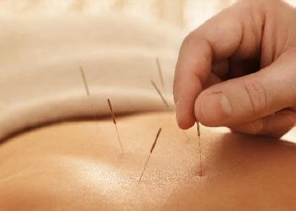 Women with menopausal hot flashes  get no relief from acupuncture