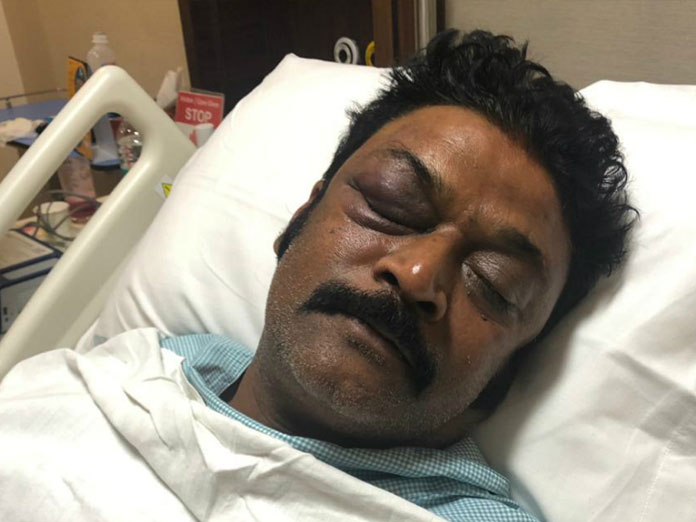 Congress MLA Anand Singh gets attacked ; sustains head injuries
