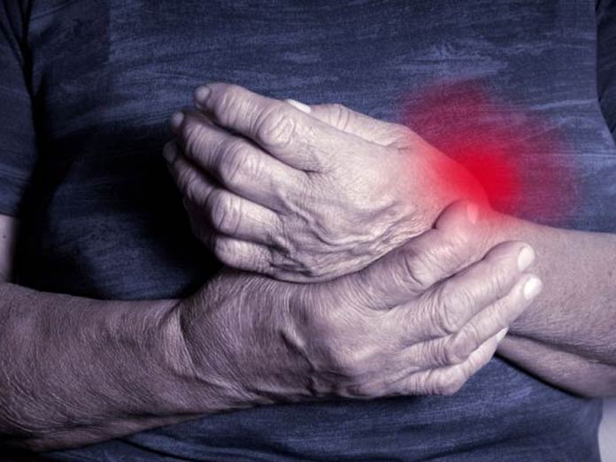 Gene discovery may lead to new treatments for osteoarthritis