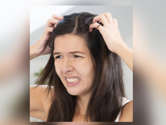 Protect your scalp from getting itchy, dry