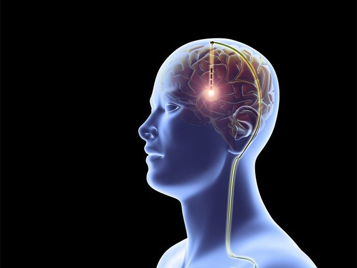 Human brain works backwards to retrieve memories