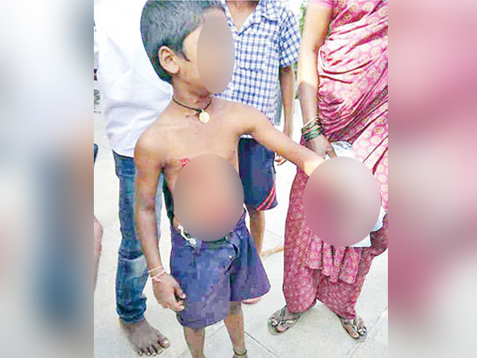 Mobile phone battery blast in Classroom hurts student in Jangaon