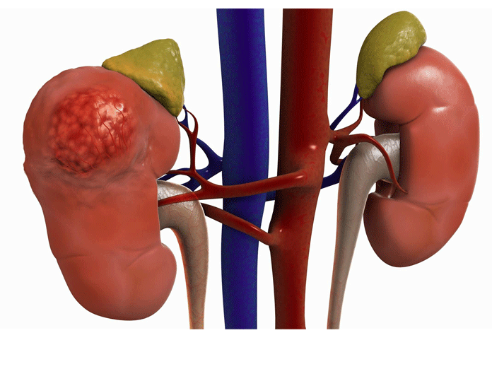 Kidney research sheds light on harms of certain drugs