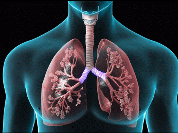 Smokers can now detox their lungs Naturally