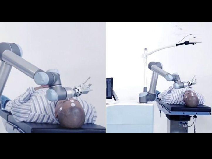 Meet Remebot, China’s first neurosurgery robot