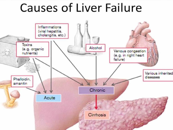 Lab grown Liver Raises Hopes For ALF Patients