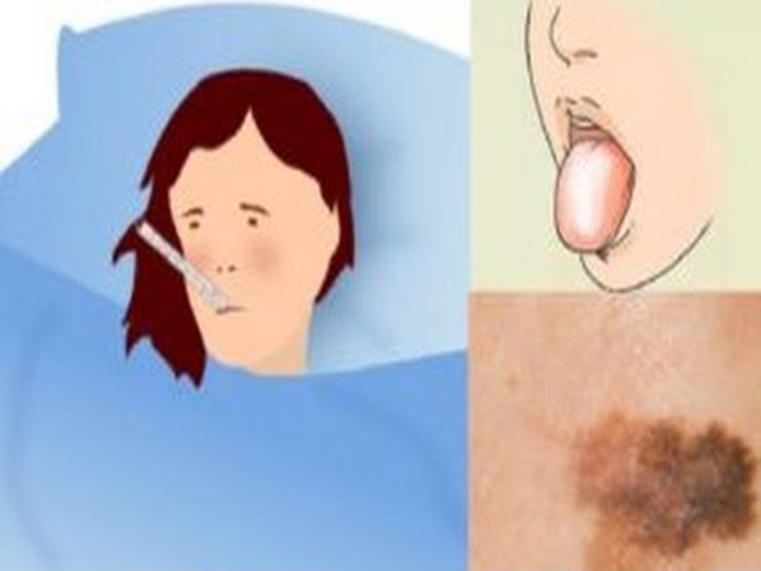 Signs of cancer one should not ignore