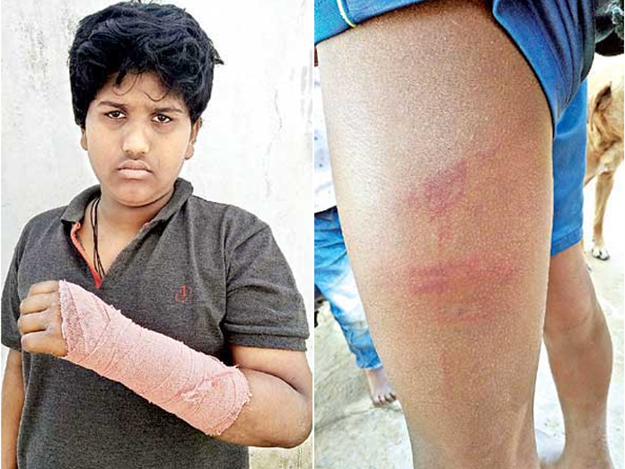 Gurukul hostel security guard thrashes students in Siddipet