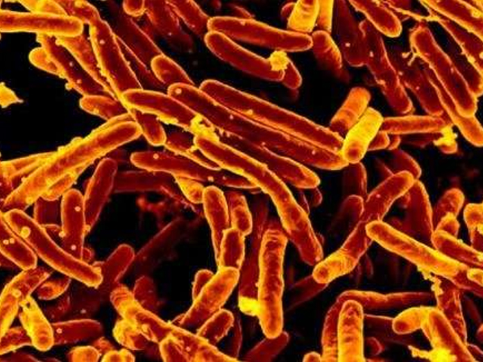Researchers identifies molecule effective in killing TB bacteria