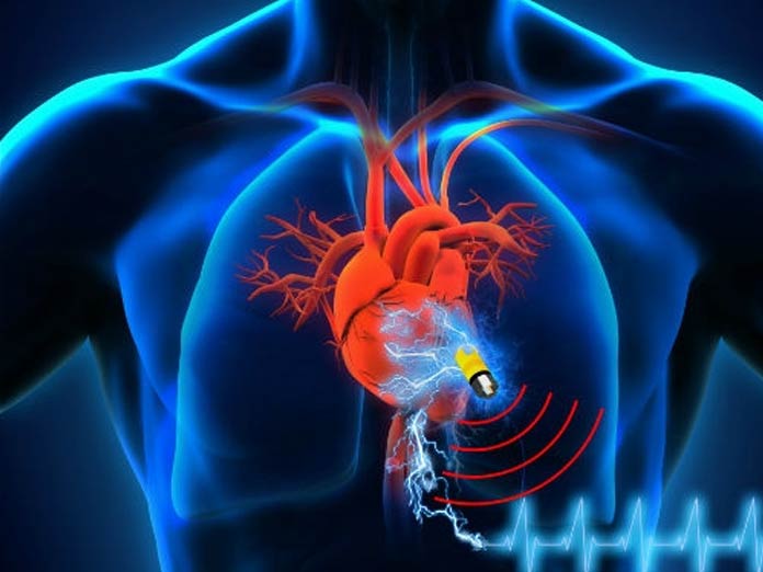 New device harvests hearts energy to power life-saving implants