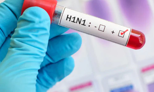 4 Women Die Of Swine Flu In Indore, Number Of Dead In 2019 Rises To 28