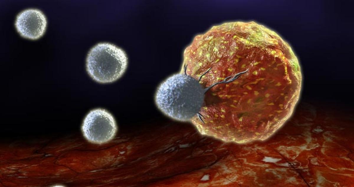 Researchers find novel way to kill cancer cells