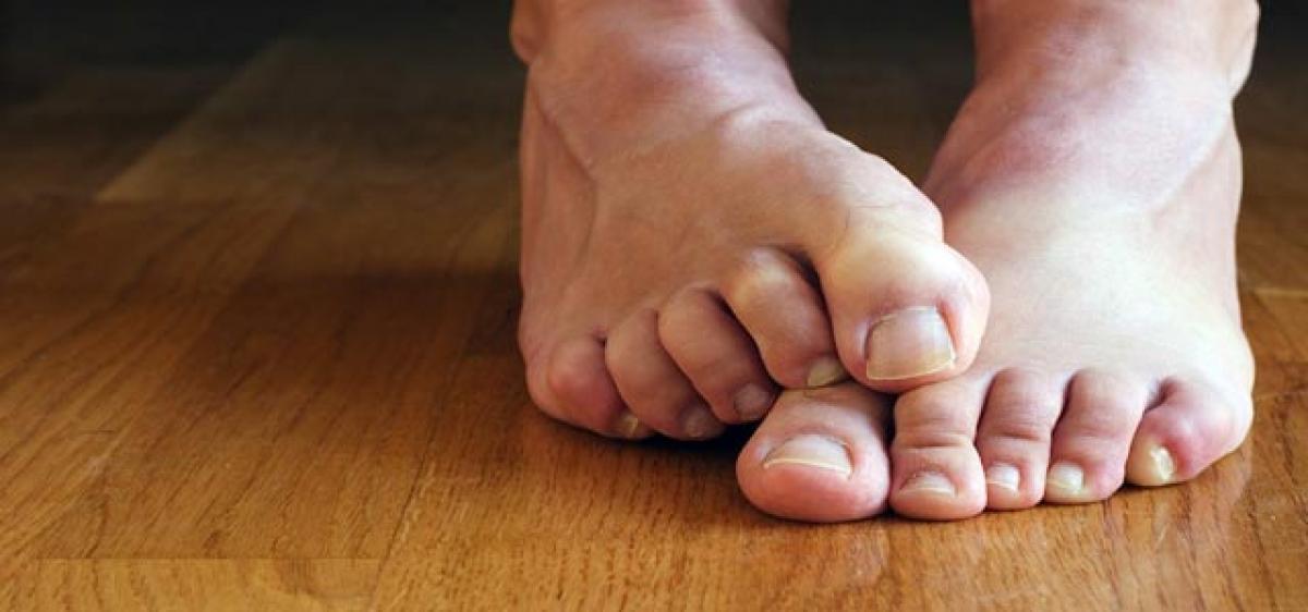 Claw Toes sign of underlying diabetes: Doctors