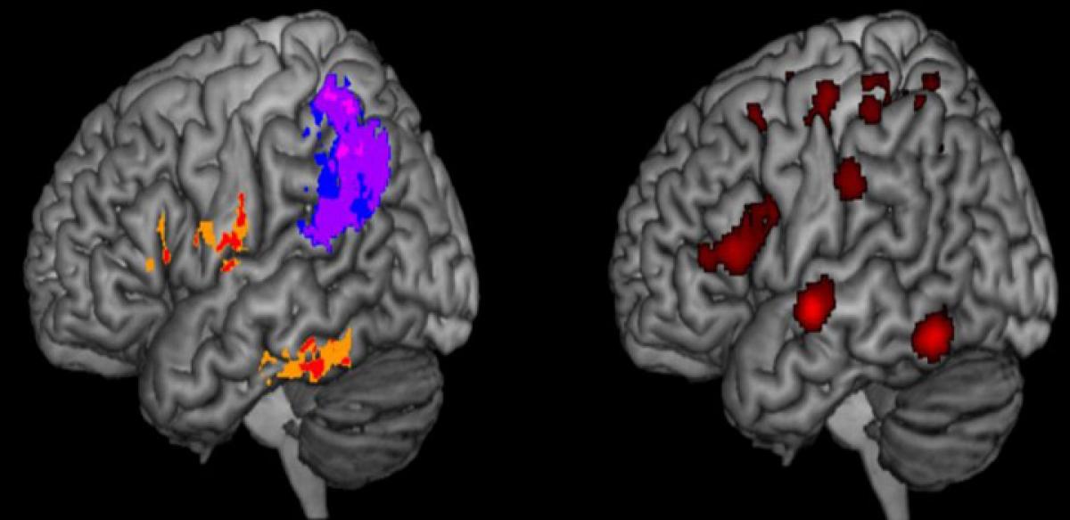 Decoded: Brain areas that control how we write words