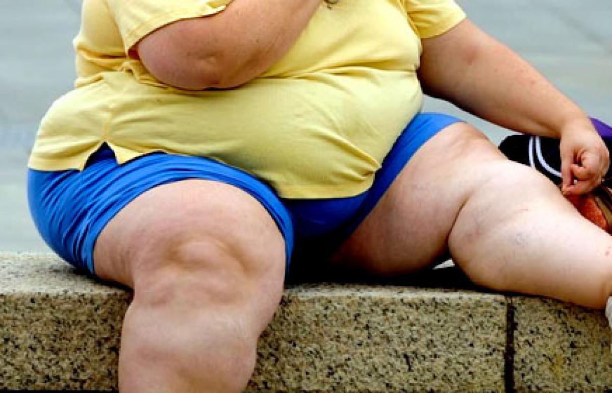 Obesity rate hits all time high in Britain: Goldman Sachs analysis