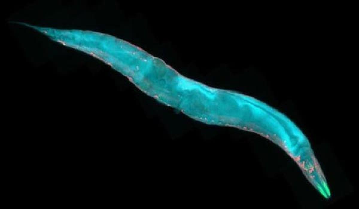 Parasitic worms can help doctors diagnose food borne infections in Northeast 